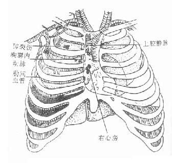 三胸二塞一氣傷|胸外科學/胸部創傷